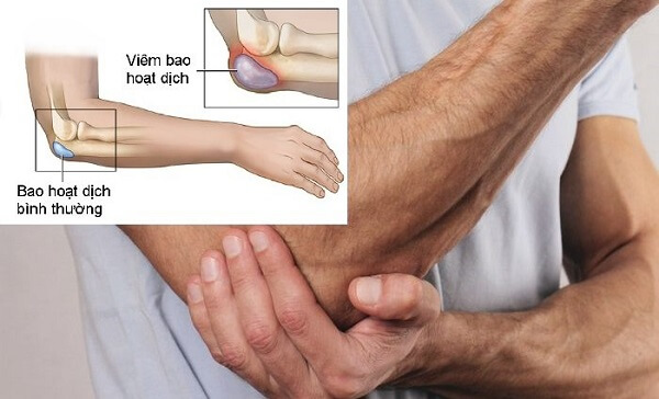 Cách massage giảm đau cánh tay
